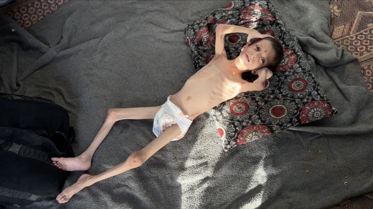 israilin kitliga surukledigi 10 yasindaki nafiz kemik yiginina donustu qN7c2raQ