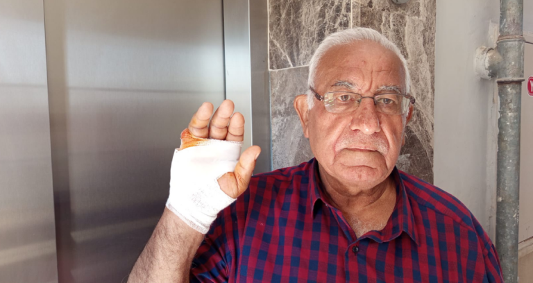 hatayda-akilalmaz-olay-cok-sevdigi-komsusu-parmagini-isirarak-kopardi-k8engeu2-1